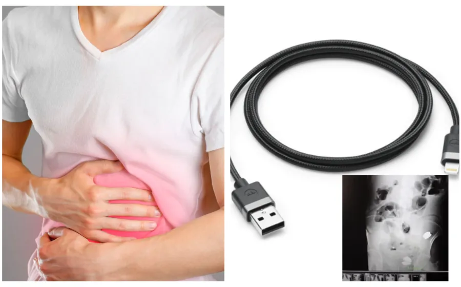 dolor_estomago_cable