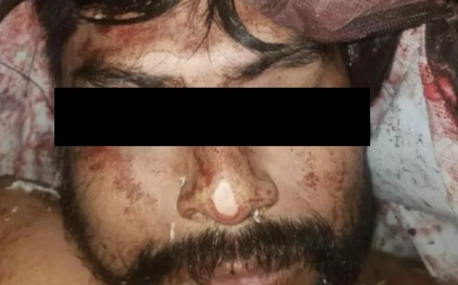 sin_identificar_cadaver