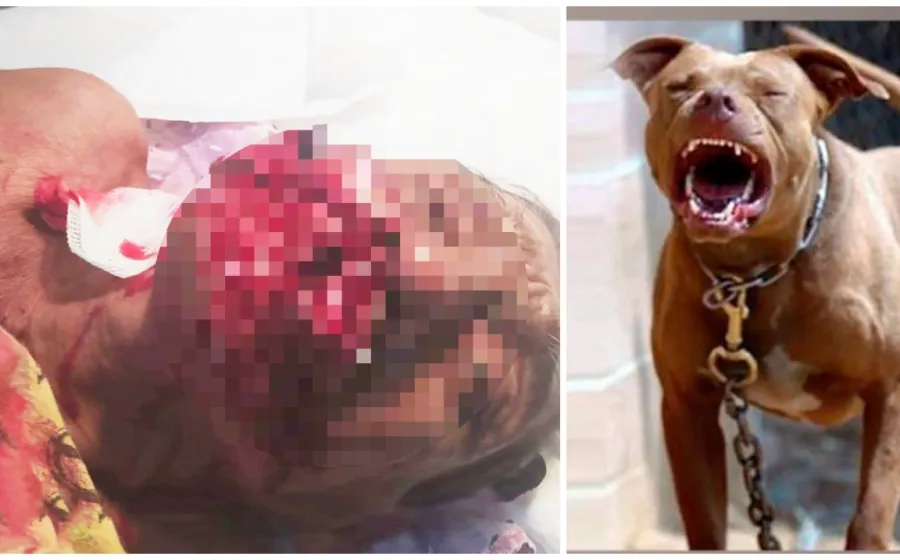 ataque_perro_anciano