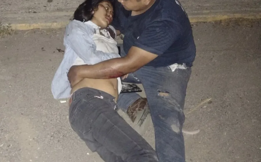 La pareja de jóvenes motociclistas resultaron lesionados tras el accidente.