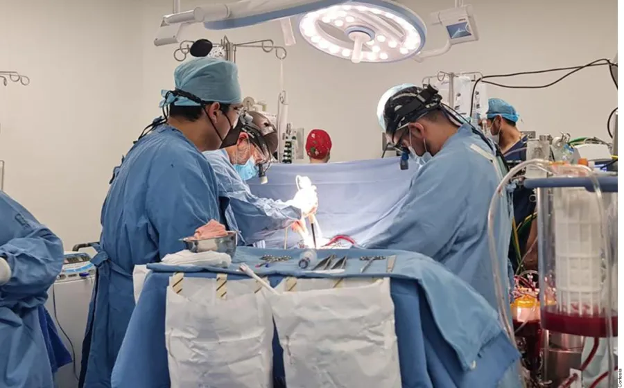 imss_transplante