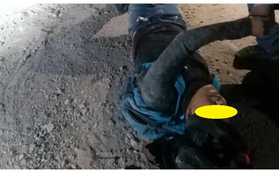motociclista_fractura