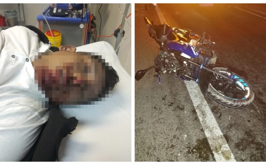 muere_motociclista_derrape