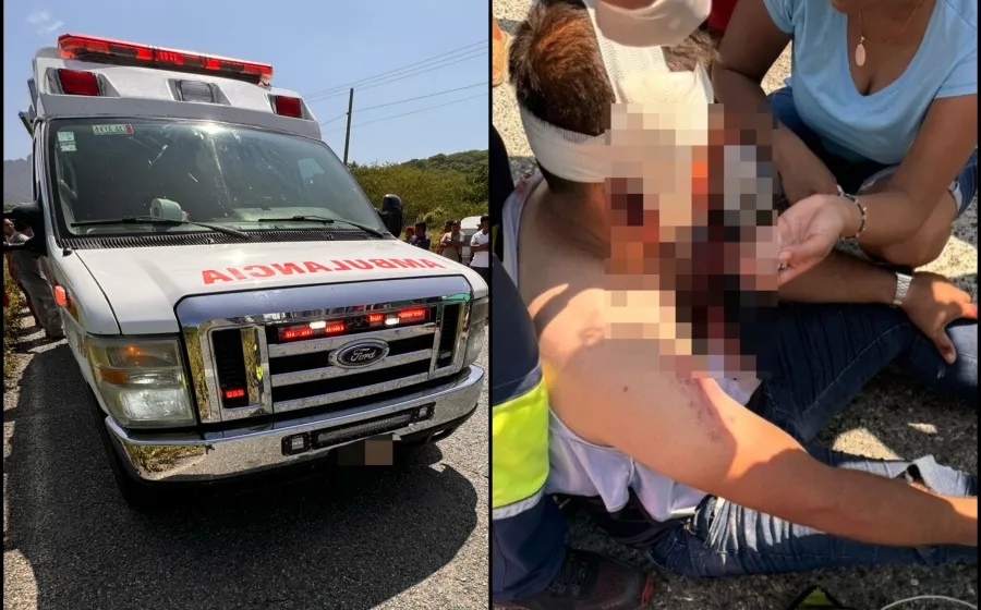 motociclista_accidente_costera