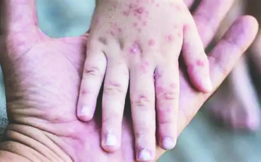 alerta_virus